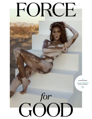 photos Winnie Harlow