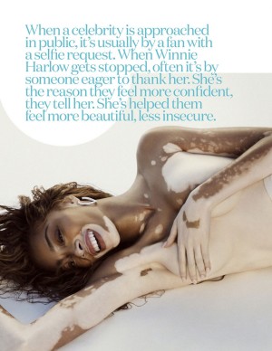 photos Winnie Harlow