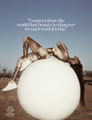 photos Winnie Harlow
