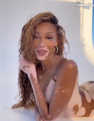 photos Winnie Harlow
