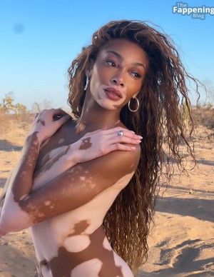 photos Winnie Harlow