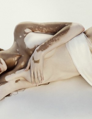photos Winnie Harlow